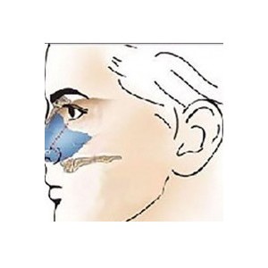 鼻中隔软骨垫鼻尖