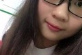 双眼皮价格多少钱及双眼皮案例展示