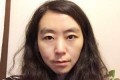 面部轮廓整形多少钱，附面部整形一个月恢复反馈图