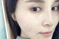 面部改良提升案例分享与果对比图