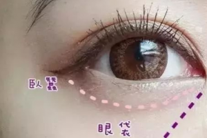 这3个沟不解决，永远显老！