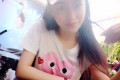成都娇点医学美容医院隆鼻整形果好不好及案例展示
