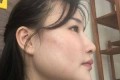 下颌骨整形案例分享与果对比图