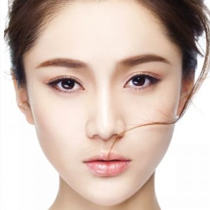 射频消融去眼袋