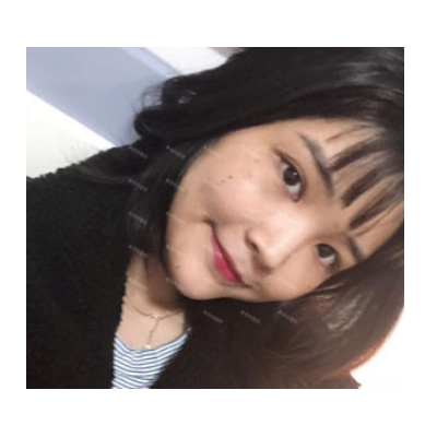 自体脂肪填充案例分享及果对比图