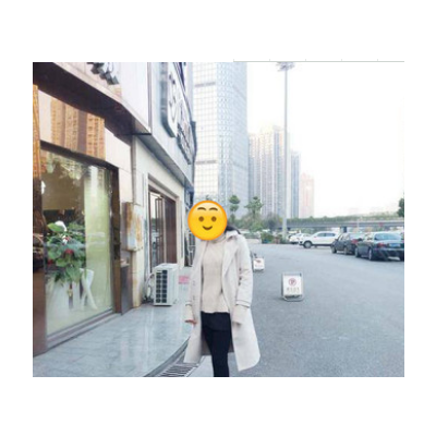 大腿吸脂案例果图分享