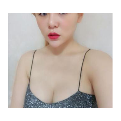 北京东方和谐自体脂肪隆胸怎么样及果案例图分享