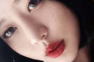 温州医科大学附属第一医院整形美容科整形价格表(价目表)全新发布