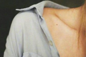 2020成都尊尚诺维亚医疗美容门诊部整形价格表(价目表)全新发布