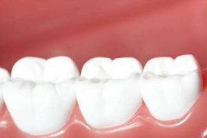2020海南爱牙口腔医院整形价格表(价目表)全新发布