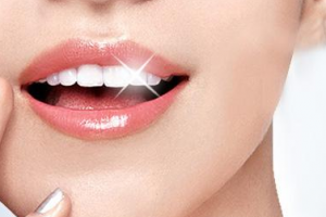 2020南京雅度口腔种植牙研究中心（普通合伙）整形价格表(价目表)全新发布