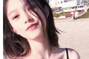 上海申江医院整形美容科王玉如整形价格表附鼻翼缩小案例展示