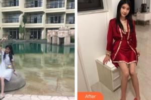 上海时光整形外科医院陈文慧整形价格表附白瓷娃娃案例展示