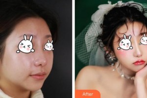 上海伊莱美医疗美容医院Dr.Li整形价格表附鼻部综合案例展示