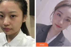 成都素美医疗美容诊所范瓅月整形价格表附超激光美肤祛斑嫩肤案例展示