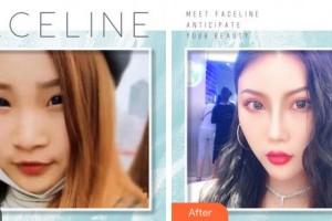 成都金荣医学美容诊所张松林整形价格表附吸脂案例展示