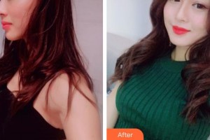 成都百龄驻颜医学美容门诊部康耀整形价格表附隆胸案例展示