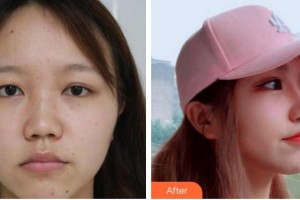 成都景华医学美容门诊部江涛整形价格表附鼻部手术案例展示