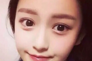 长沙臻颜医疗美容门诊部张浩整形价格表附激光祛斑案例展示