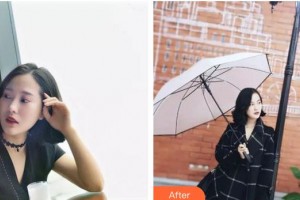 合肥贝杰口腔医院何初华整形价格表附牙贴面案例展示