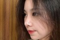 智美颜和医疗美容王萃鼻部手术|打造精致自然翘鼻价格表及案例恢复果对比图