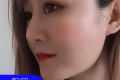 天津伊美尔医疗整形美容专科医院卫星鼻部综合 • 天津伊美尔价格表及案例恢复果对比图