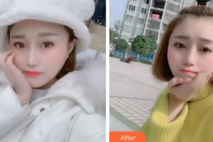 安庆渡江口腔医院朱传定整形价格表附牙齿矫正案例展示