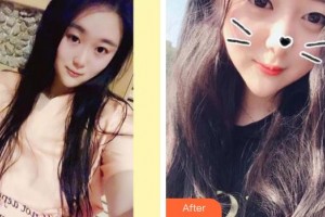亳州康美口腔医院武春勤整形价格表附牙齿矫正案例展示