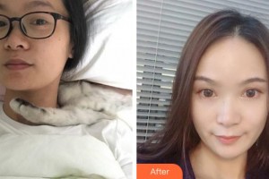 杭州启美医疗美容医院武安善整形价格表附热玛吉案例展示