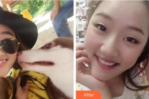 杭州美奥口腔门诊部李艳杰整形价格表附牙齿隐形矫正案例展示