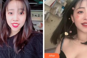 杭州美奥口腔门诊部纪凤贺整形价格表附金属托槽矫正案例展示