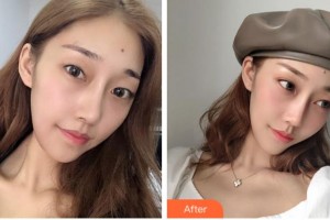 杭州求是眼科医院刘文群整形价格表附眼部综合案例展示