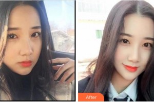 杭州牙科医院毕文翔整形价格表附冷光美白案例展示