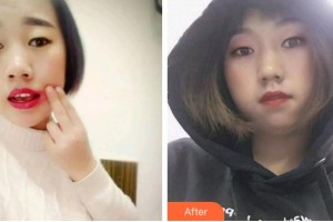 杭州协友口腔门诊部沈月忠整形价格表附根管调节案例展示