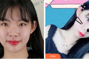 杭州薇琳医疗美容医院刘淑芹整形价格表附热玛吉案例展示