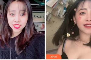 杭州博凡口腔门诊部贾旭整形价格表附金属托槽矫正案例展示