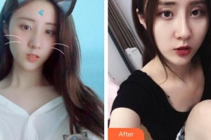 嘉兴华山医疗美容医院朱凌贤整形价格表附激光祛斑案例展示