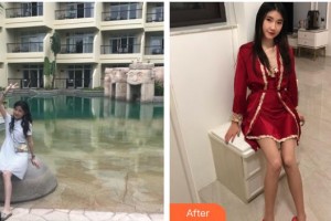 湖州曙光医疗美容门诊部范菁整形价格表附白瓷娃娃案例展示