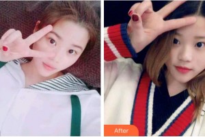 宜宾西婵钧阁医学美容诊所谢贻恒整形价格表附冷光美白案例展示