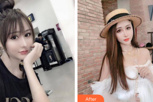 佛山华美整形美容医院梁宗建整形价格表附鼻部手术案例展示