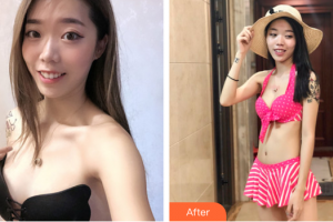 佛山壹加壹玛丽娅整形美容医院郝冬整形价格表附自体脂肪隆胸案例展示