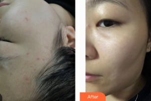 东莞百佳玛丽亚妇产医院何立整形价格表附祛斑案例展示