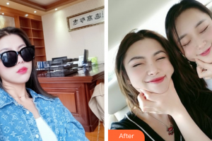 东莞韩美整形医院朴正淳整形价格表附水光补水案例展示