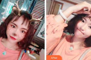 东莞瑞芙臣医疗美容门诊部ColetteC整形价格表附超微小气泡案例展示
