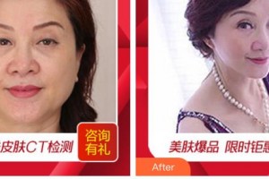 秦皇岛纪辉整形美容医院朱改芬整形价格表附皮肤修复案例展示