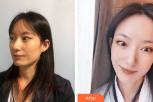 中山美南华整形美容医院金健整形价格表附皮肤美容案例展示