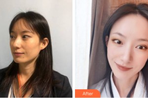 桂林熊名田医疗美容诊所朱晓荣整形价格表附皮肤美容案例展示