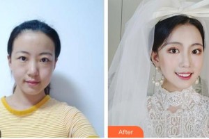 呼和浩特任荣大韩医疗美容诊所张高贵整形价格表附眼部综合案例展示