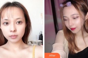 六盘水吴氏嘉美医疗美容门诊部杨远平整形价格表附微针美肤案例展示