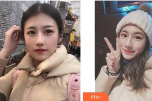 武警广西总队医院医学整形美容中心夏天整形价格表附美白导入案例展示